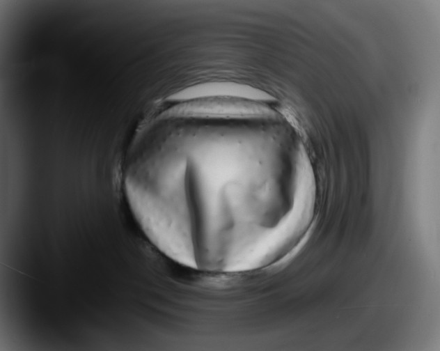 X0000087560190200705181131