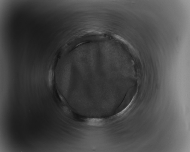 X0000087560192200705181131