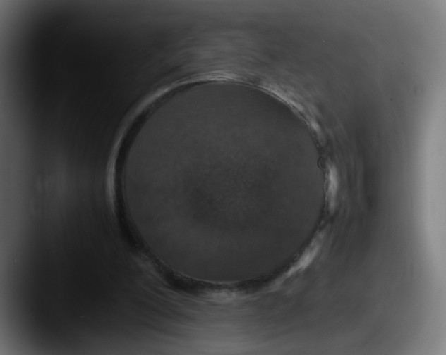 X0000087560200200705181131