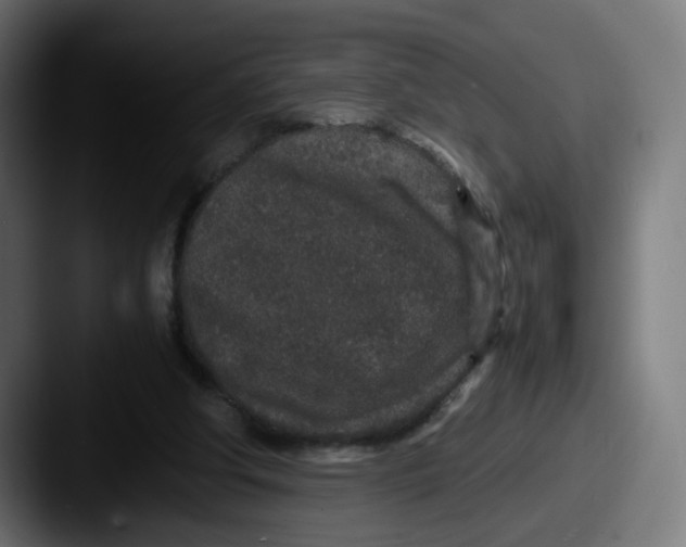 X0000087560202200705181131