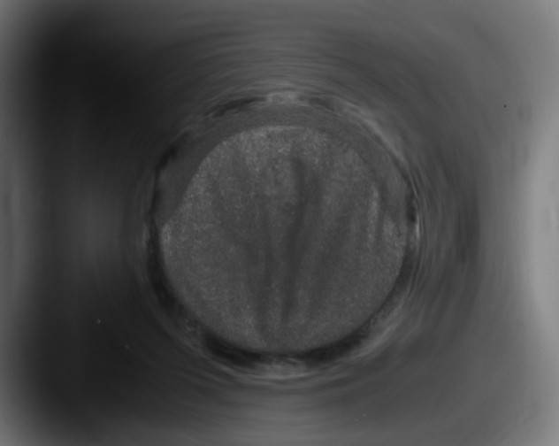 X0000087560215200705181130