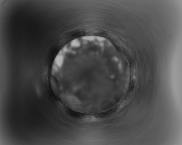 X0000087560519200705181127