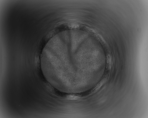 X0000087560614200705181126