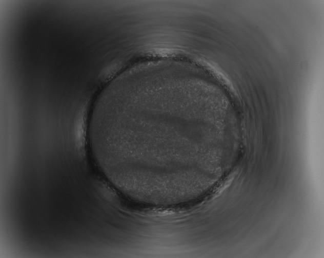 X0000087560640200705181125