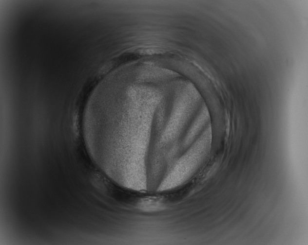X0000087560700200705181125