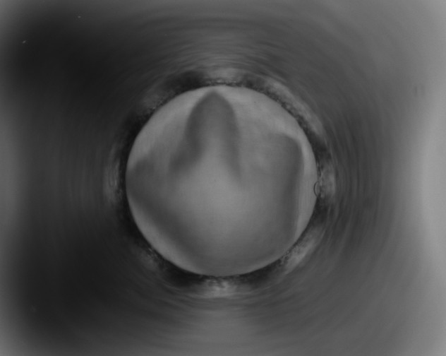 X0000087560764200705181124