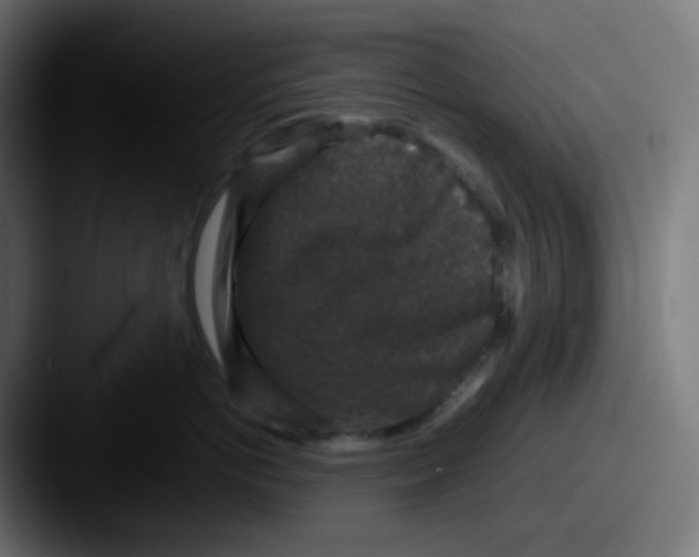 X0000087560766200705181124