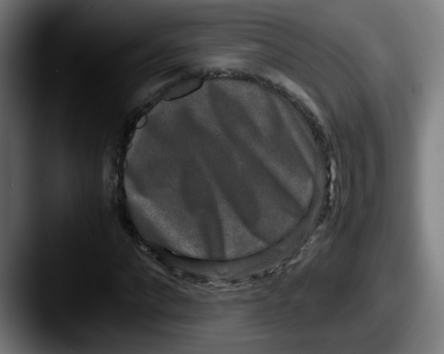 X0000087560872200705181123