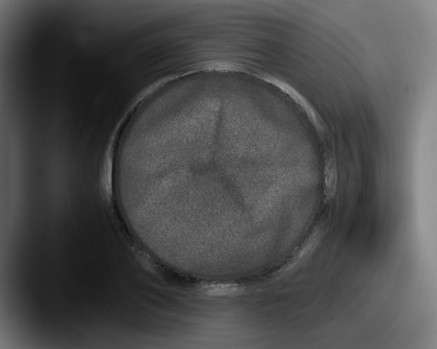 X0000087560886200705181122