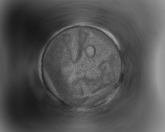 X0000087560903200705181122