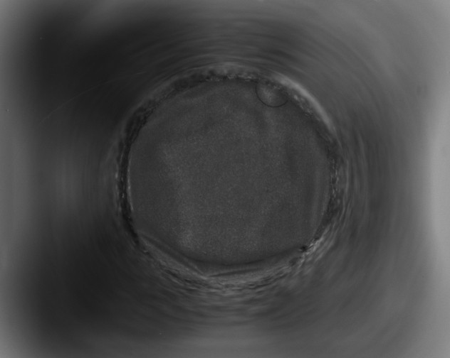 X0000087560919200705181122