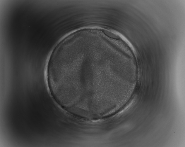 X0000087560951200705181122