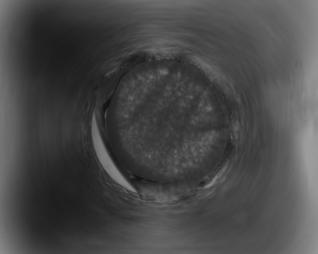 X0000087561010200705181120