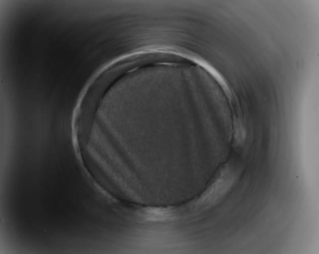 X0000087561102200705181120