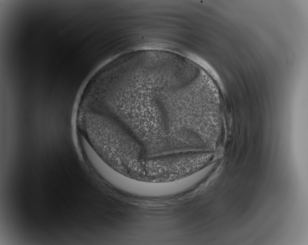 X0000087561138200705181120