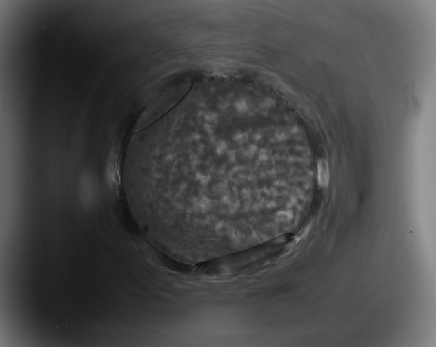 X0000087561155200705181119