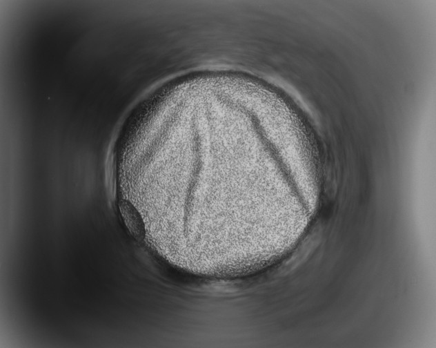 X0000087561175200705181119