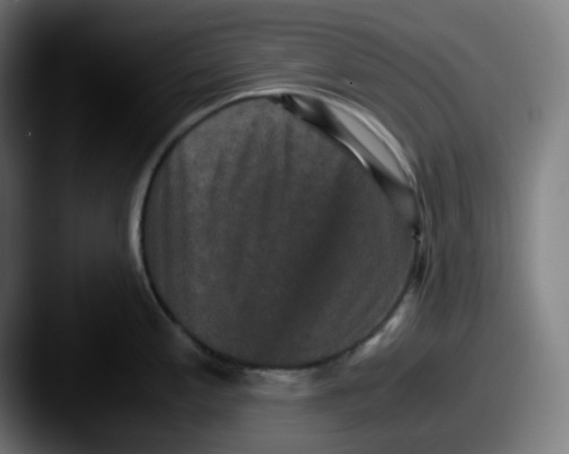 X0000087561197200705181119