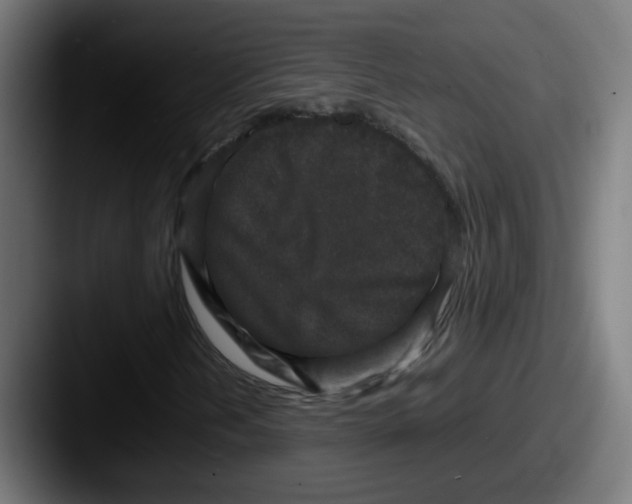 X0000087561202200705181118