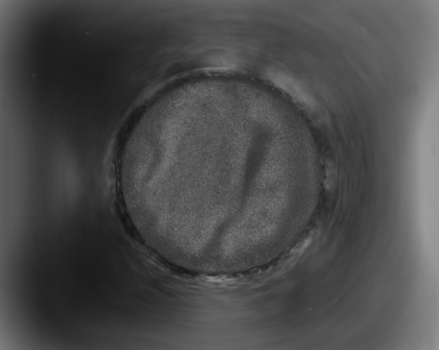 X0000087561208200705181118