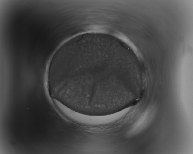 X0000087561383200705181117