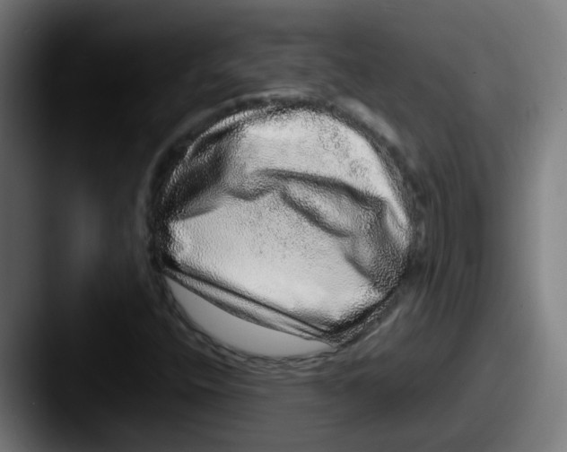 X0000087561400200705181116