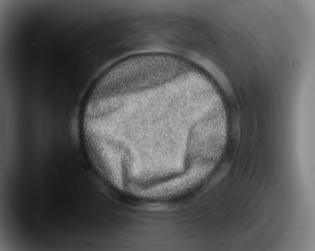 X0000087561460200705181116
