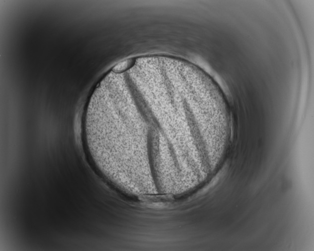 X0000087561500200705181115