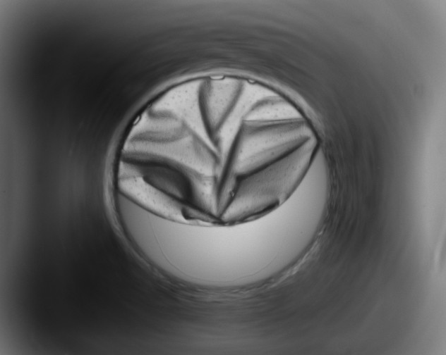 X0000087561518200705181115