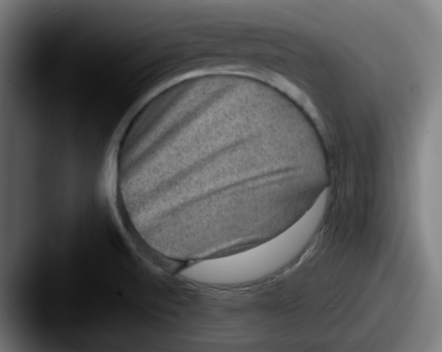 X0000087561520200705181115