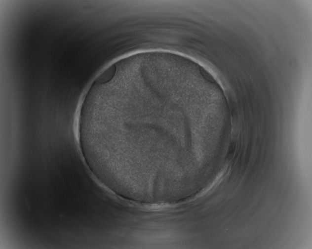 X0000087561535200705181115