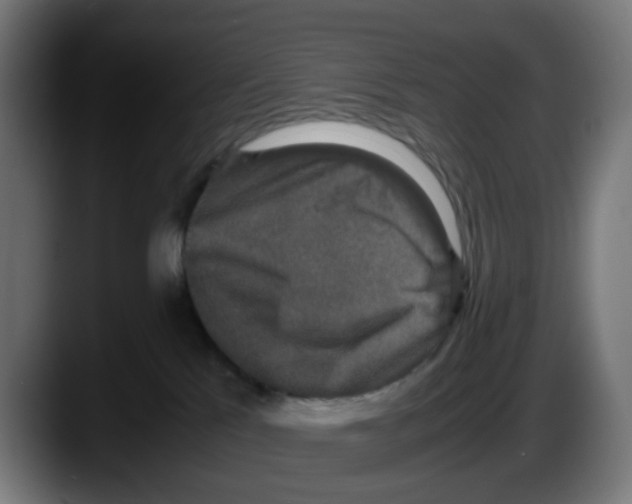 X0000087560041200705251809