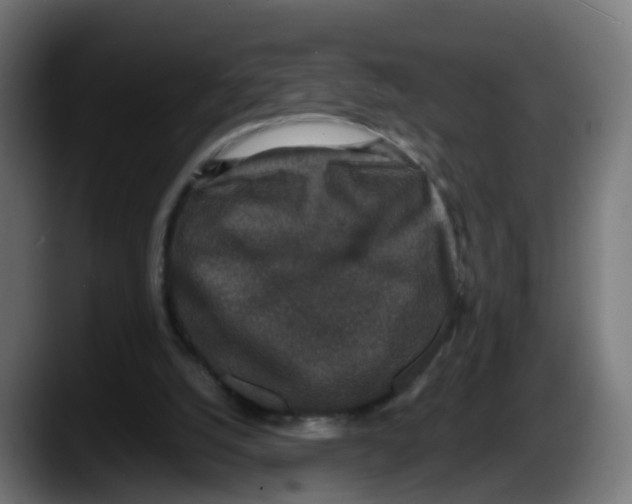 X0000087560056200705251808