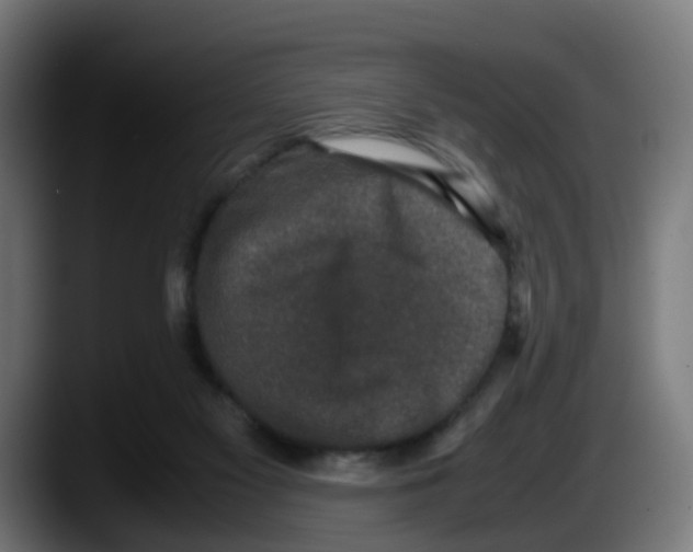 X0000087560117200705251808
