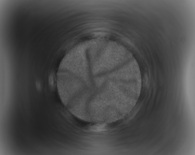 X0000087560138200705251808