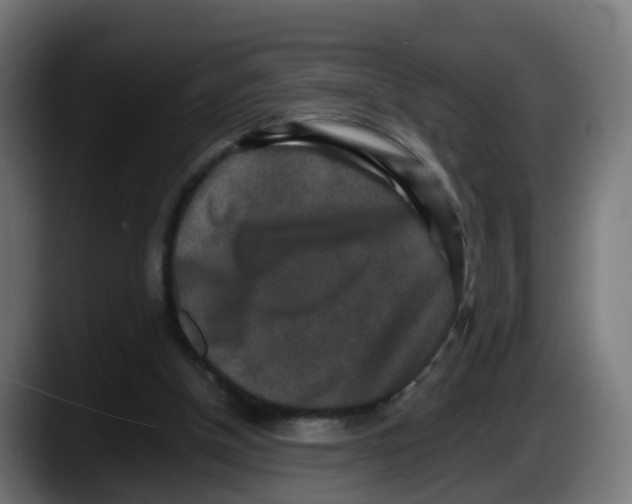 X0000087560154200705251807
