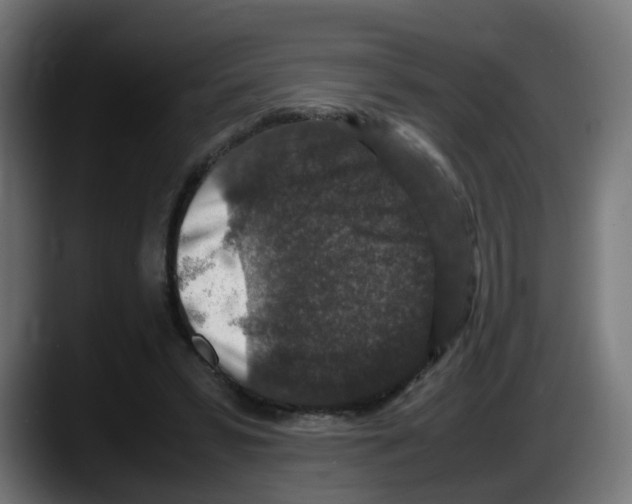 X0000087560399200705251804