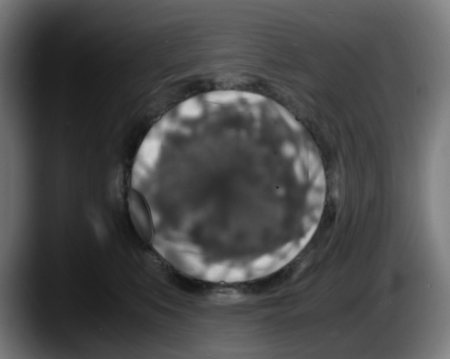 X0000087560519200705251803