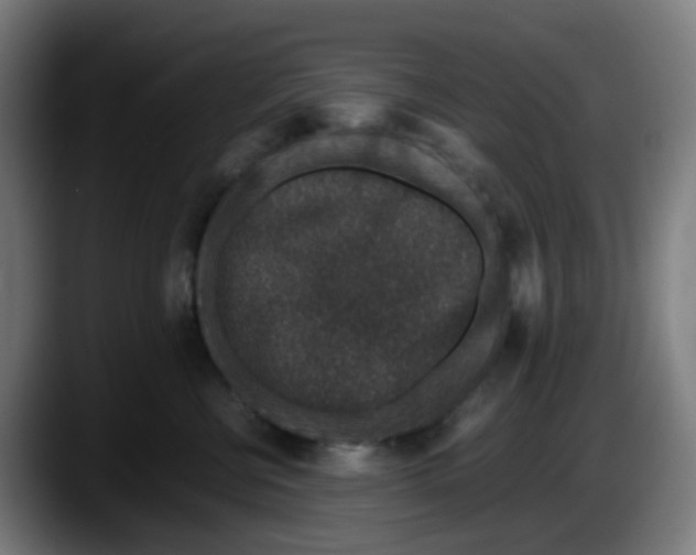 X0000087560570200705251803