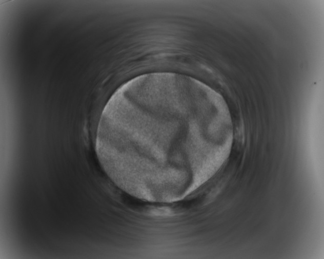 X0000087560572200705251803