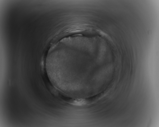 X0000087560720200705251800