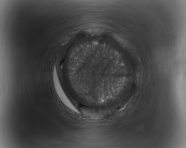 X0000087561010200705251756