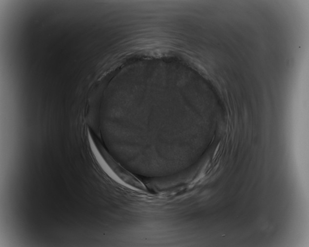 X0000087561202200705251753