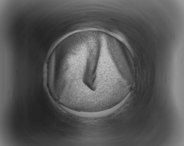 X0000087561524200705251750