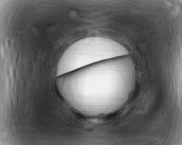 X0000087570561200704270945