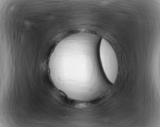 X0000087570611200704270945