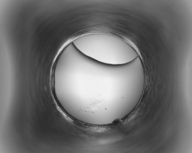 X0000087571103200704270939