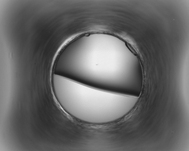 X0000087571191200704270938
