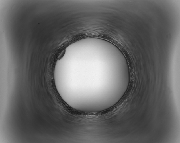 X0000087571297200704270936