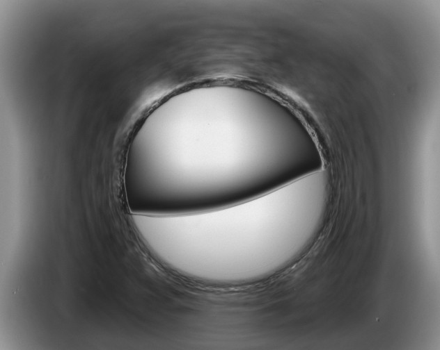 X0000087571359200704270936